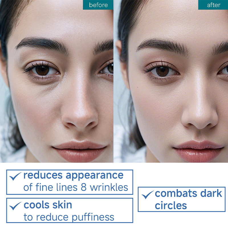 OEM Anti-Aging Eye Cream with Retinol and Hyaluronic Acid Wholesale Available(pic3)