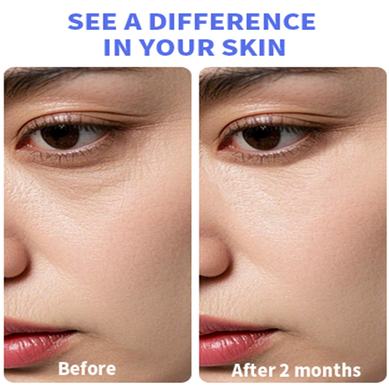 Yerba Mate Wake up Eye Gel With Hyaluronic Acid, Caffeine for Hydrate, Minimize Puffiness, Swelling(pic5)