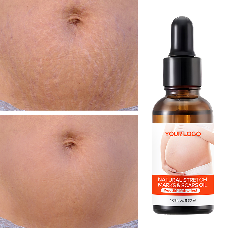 Wholesale Organic Postpartum Belly Texture Repair Skin Lubrication and Moisturizing Scar Healing Essential Oil(pic5)