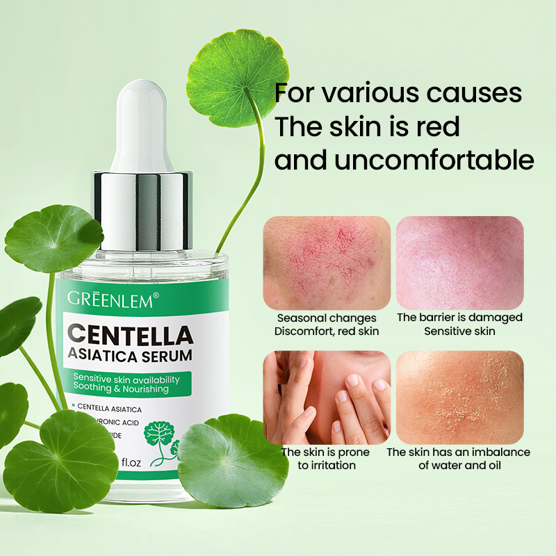 OEM/ODM Customized Korean Cica Centella Asiica Serum for Soothing Repair(pic2)