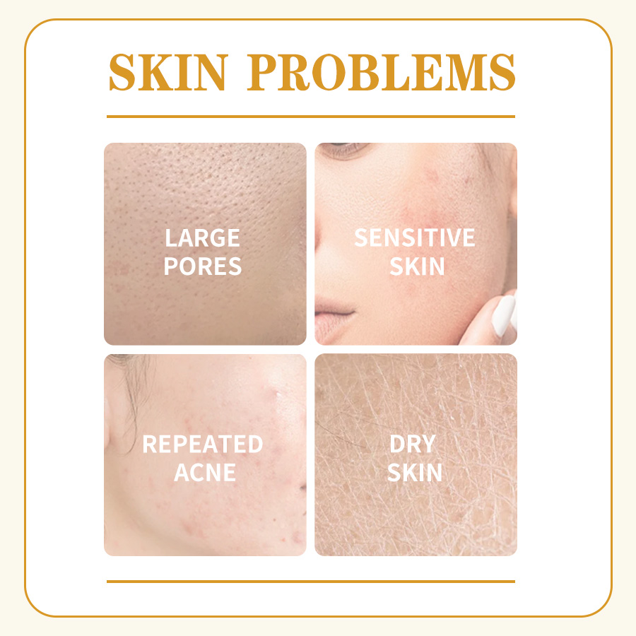 GreenLem Beauty Chamomile Masque Peel Sheet Lightening Facial for Combination Skin Moisturizing Face(pic2)