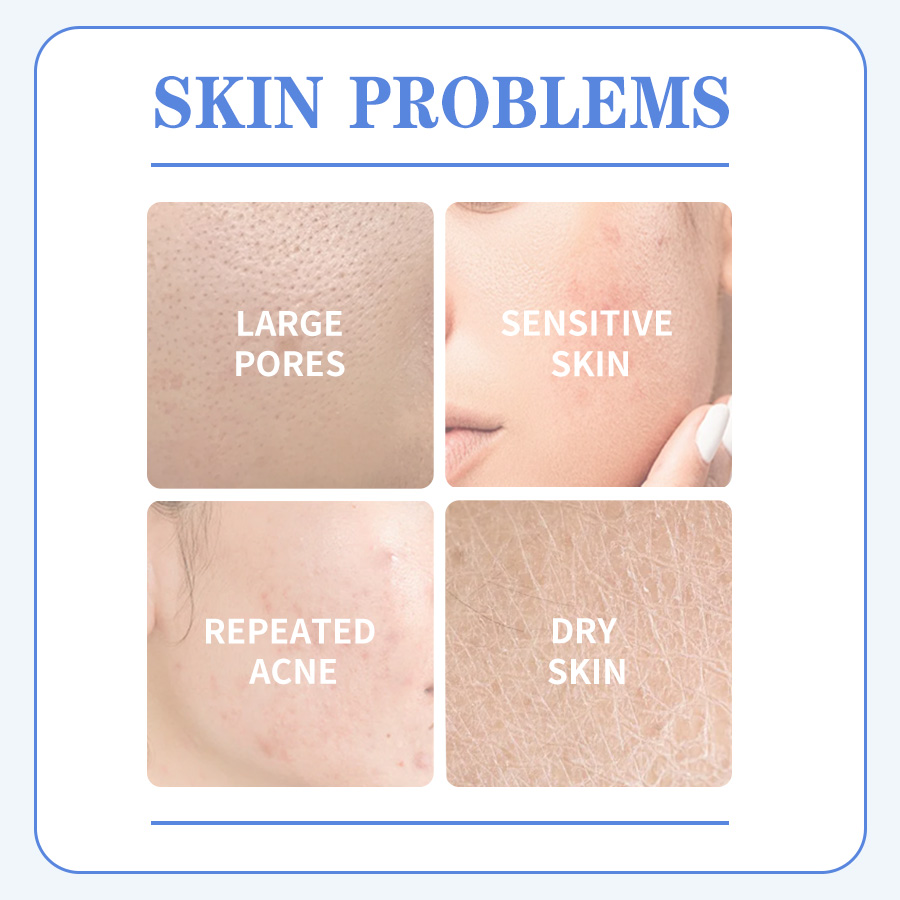 GreenLem Moisturizing Face Wholesale Private Labels Sheet Form Oil Control and Acne Removal Facial(pic2)