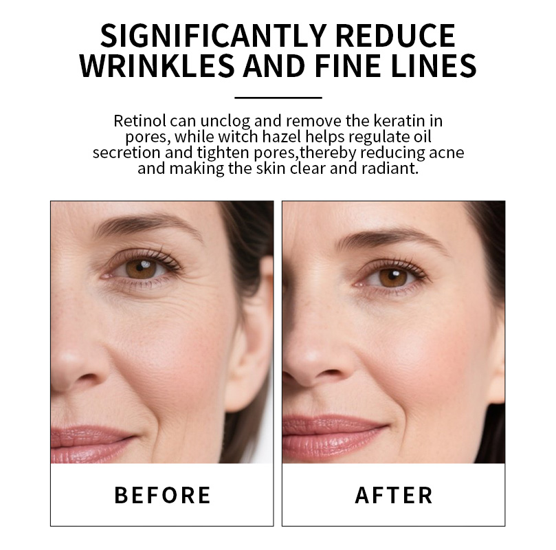 Private Label 30ML Dark Spot Remover Firming Skin Anti Wrinkles Anti Aging Moisturizing Retinol Serum(pic1) Private Label 30ML Dark Spot Remover Firming Skin Anti Wrinkles Anti Aging Moisturizing Retinol Serum(pic1)