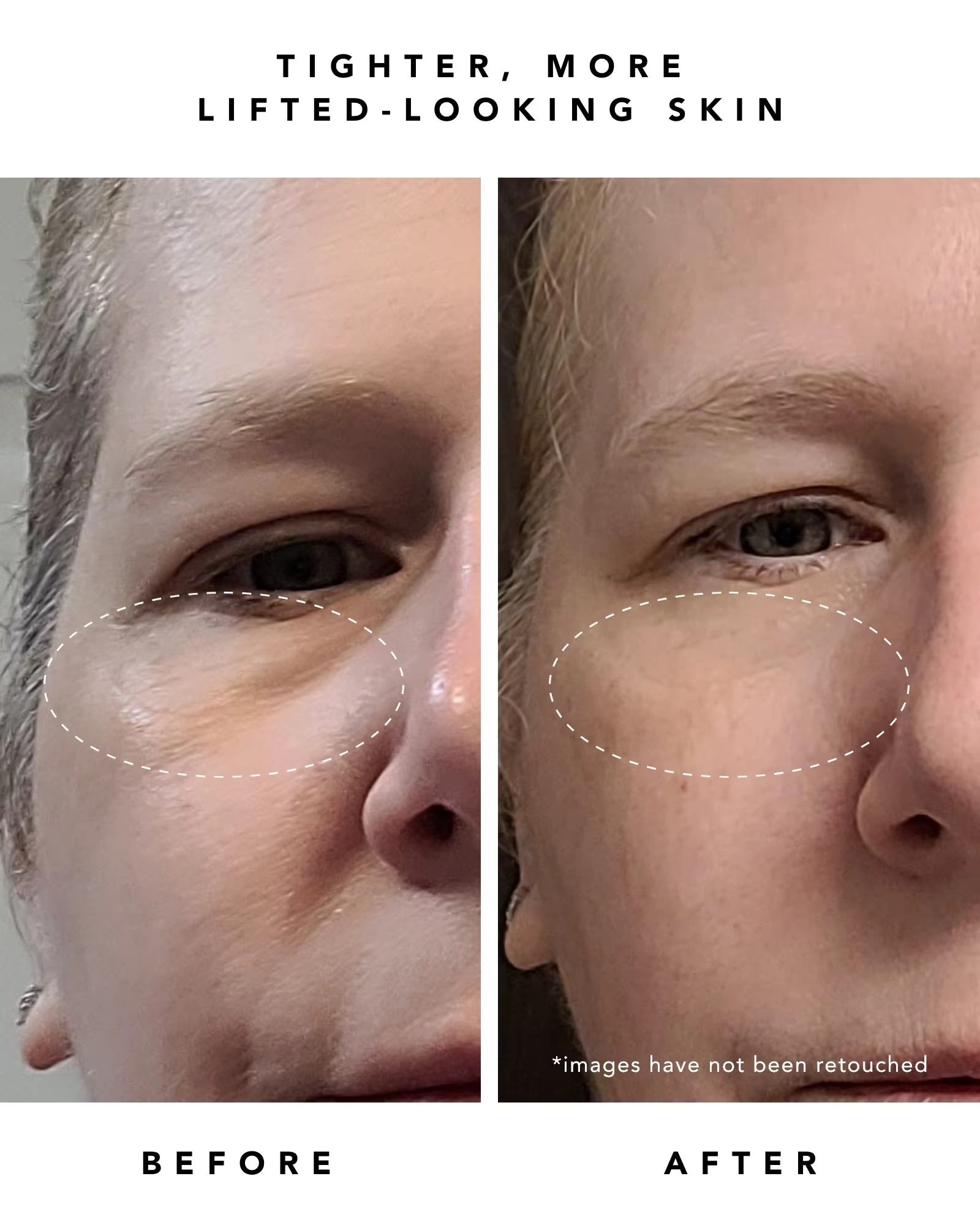 Private Label 30ML Dark Spot Remover Firming Skin Anti Wrinkles Anti Aging Moisturizing Retinol Serum(pic7) Private Label 30ML Dark Spot Remover Firming Skin Anti Wrinkles Anti Aging Moisturizing Retinol Serum(pic7)