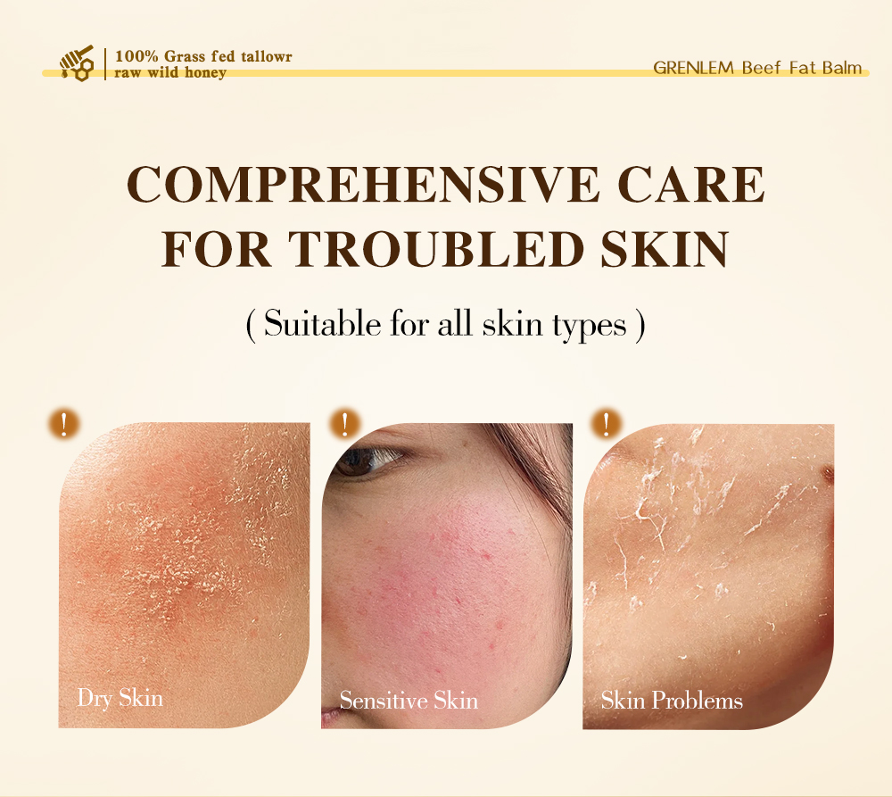 GreenlemTALLOW STICK BEEF FAT BALM(pic2)