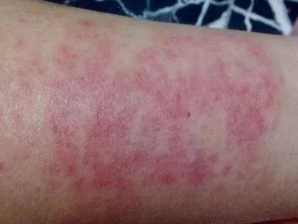 Australian tea tree essential oil shower gel removes mites, removes acne, and keeps skin healthy(pic9) image.png