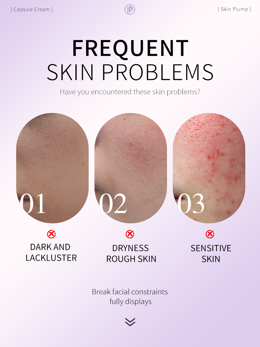 Icesea Grape Seed Capsule Cream-Lightweight Hydrating Face Moisturizer for Smoother Skin and Brighter Complexion(pic2)