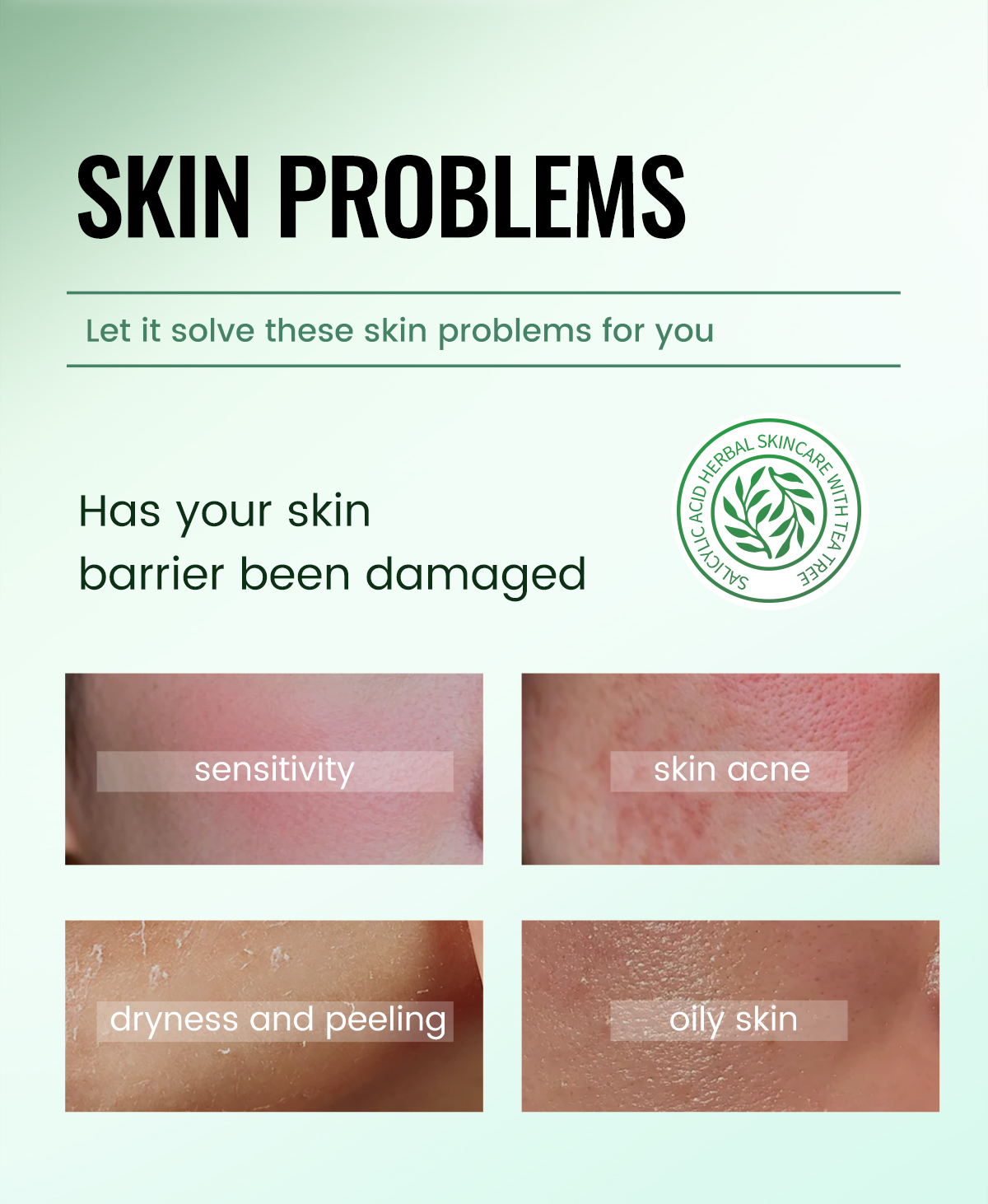 ICESEA Premium Australian Tea Tree Salicylic Acid Acne Care Set Mild Plant-Based Exfoliator Acne Scar Remover Serum Collection(pic2)