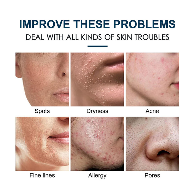 Icesea Sensitive Oily Combination Skin Hyaluronic Acid Vitamin C Brightening Nourishing Sheet Facial(pic2)