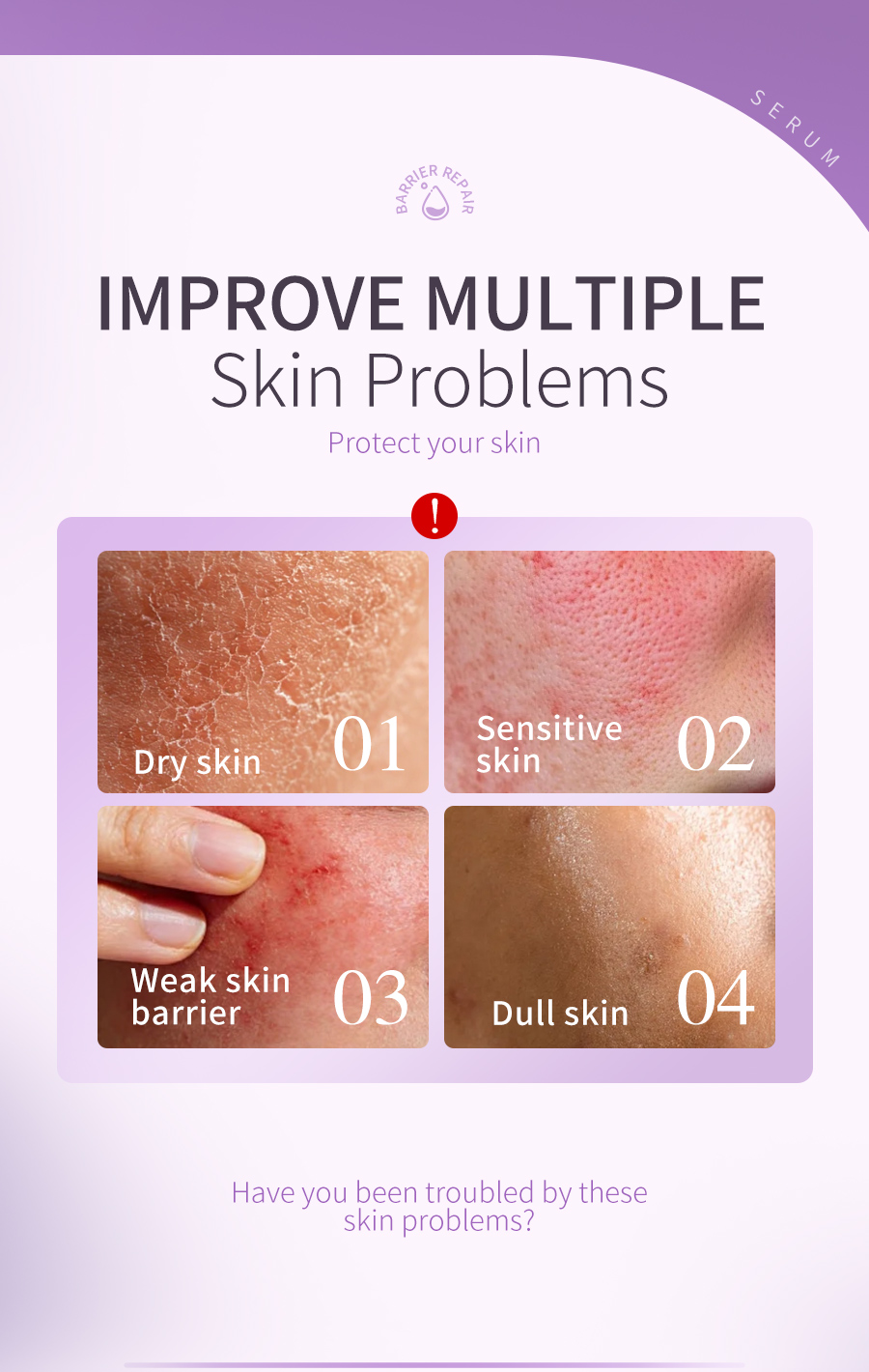 Private Label Barrier Repair Serum 30ml Ceramide Niacinamide OEM Skin Care(pic2)